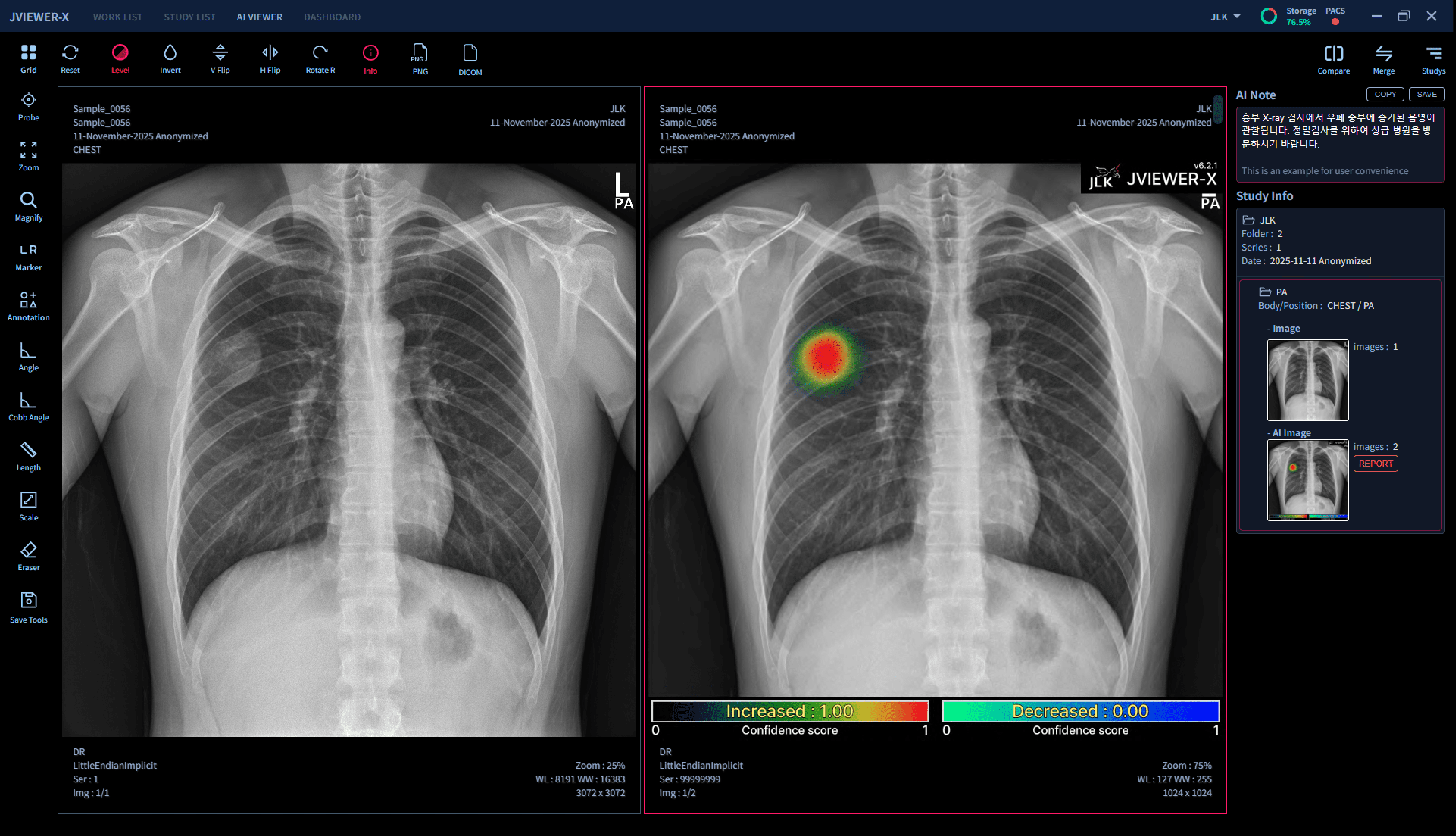 JVIEWER-X Feature 1