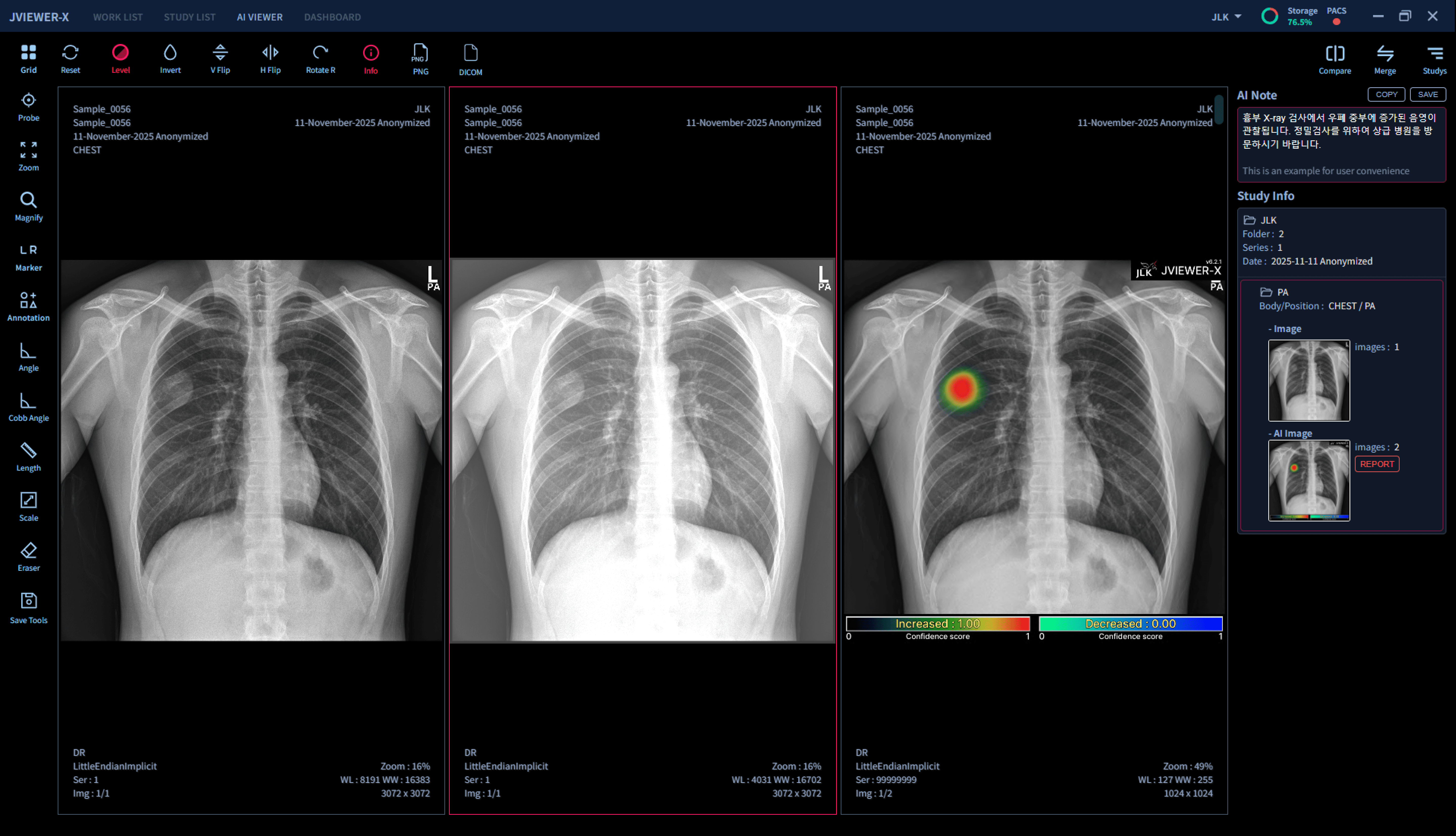 JVIEWER-X Feature 2