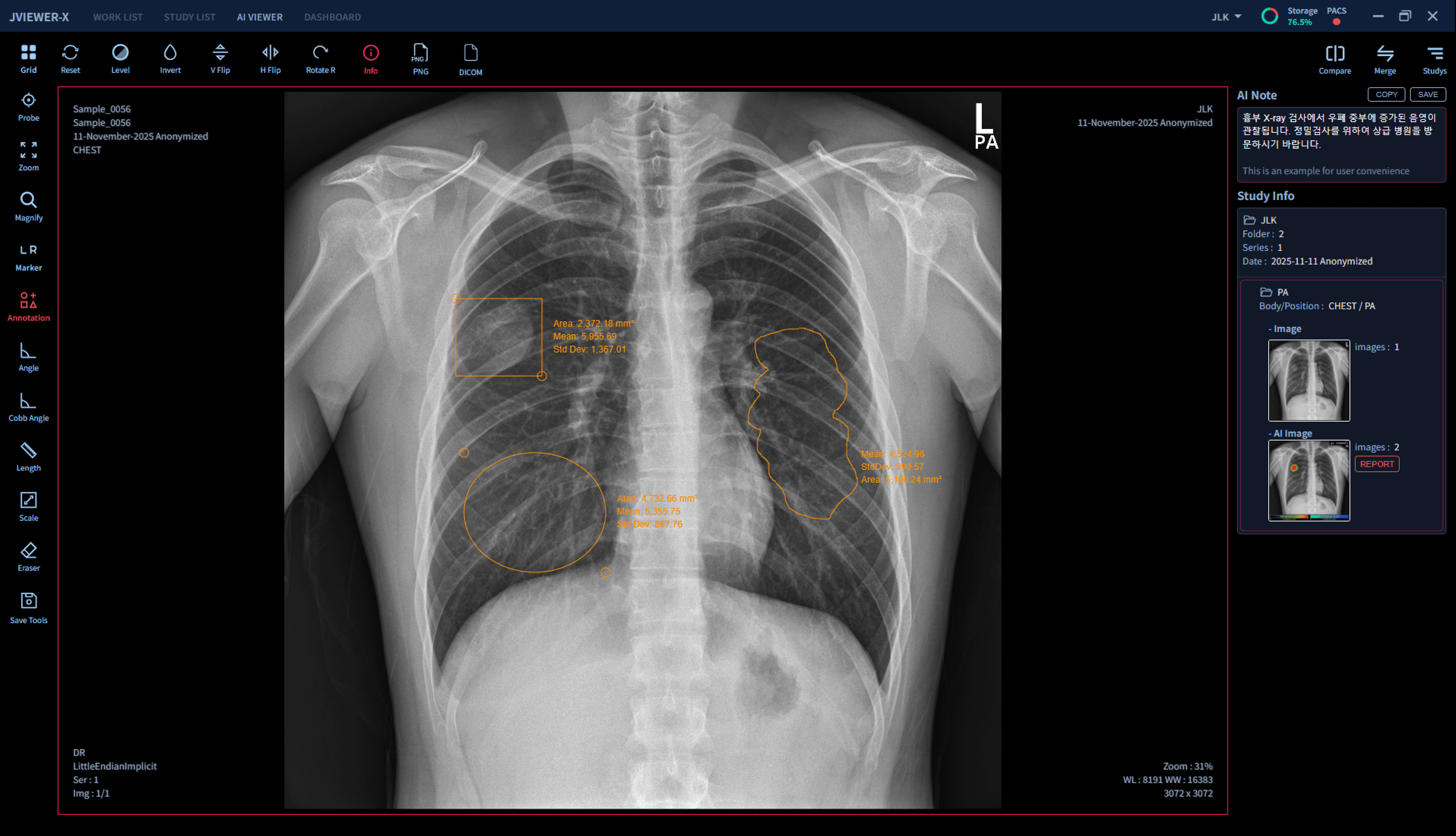 JVIEWER-X Feature 3